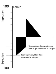 APRV:  Normal T Low 