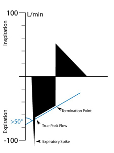 APRV "False Flow Spike"