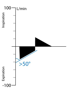 APRV:  Obstruction